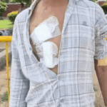 चंडीगढ़- मां ने बेटे को बचाने के लिए किडनी दी:मोहाली में ₹7 लाख का ट्रांसप्लांट फेल, अब मां-बेटे दोनों बीमार; 1 बीघा जमीन भी बिकी
