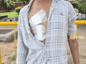 चंडीगढ़- मां ने बेटे को बचाने के लिए किडनी दी:मोहाली में ₹7 लाख का ट्रांसप्लांट फेल, अब मां-बेटे दोनों बीमार; 1 बीघा जमीन भी बिकी
